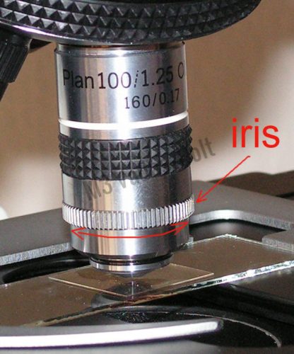 Planobjektív (100x) iriszblendével sötéttérvizsgálathoz